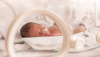 Baby in incubator with HIE - Hypoxic Ischemic Encephalopathy