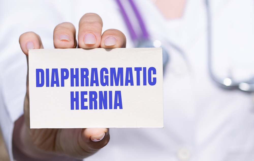 Diaphragmatic Hernia sign. Diaphragmatic Hernia Lawyer
