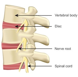 back injuries