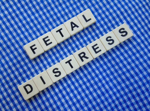 Baltimore Fetal Distress Lawyer