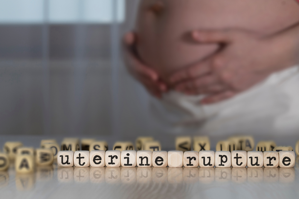 Baltimore Uterine Rupture Lawyer