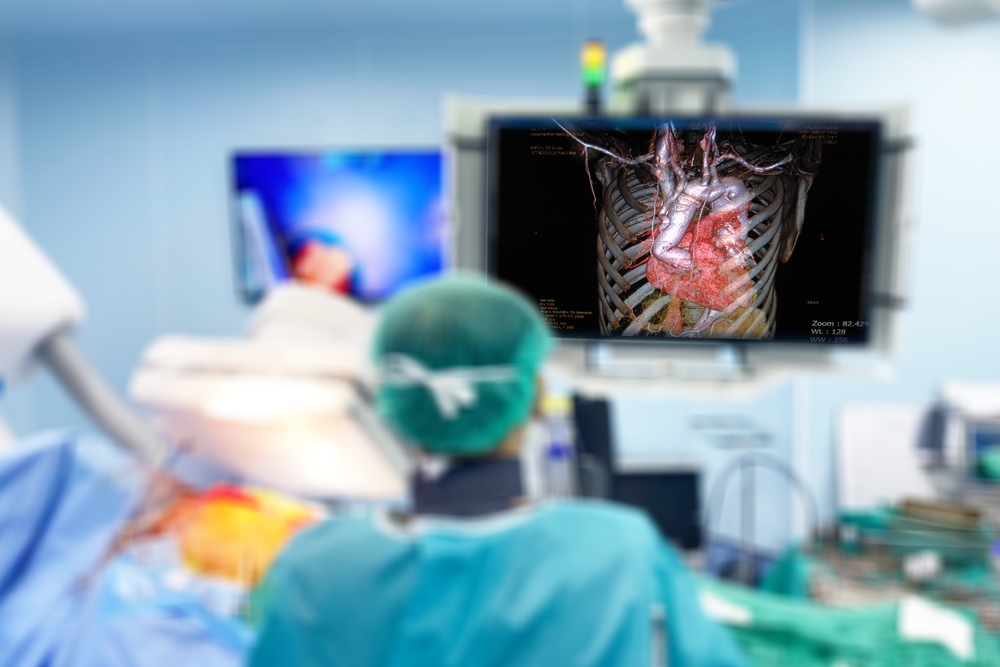 Baltimore Cardiac Surgeon Lawyer