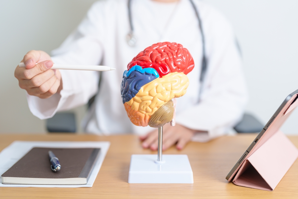 Stroke Misdiagnosis