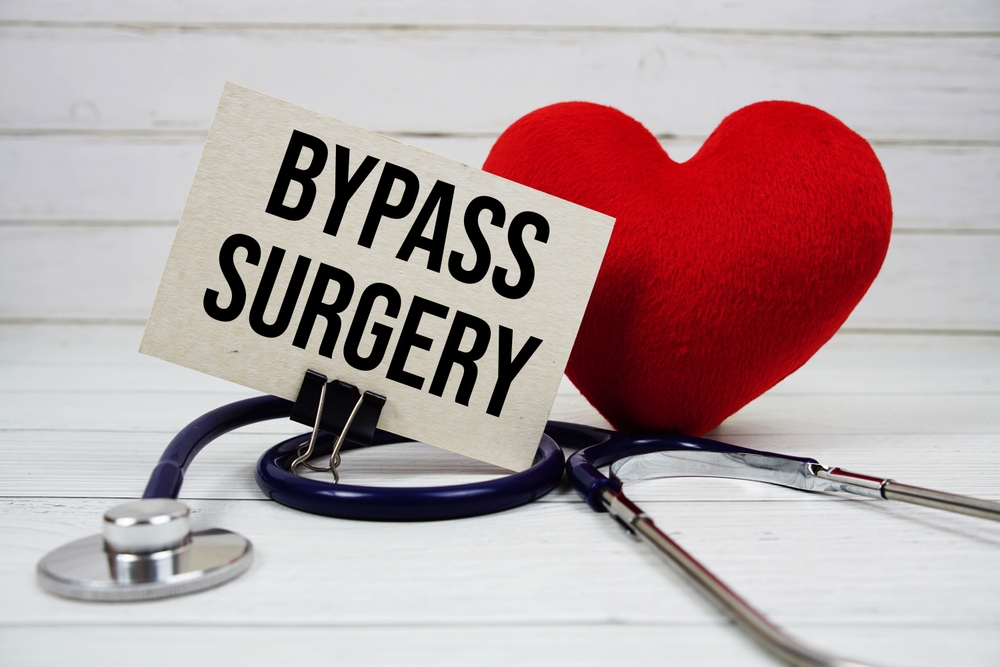 Heart Bypass Medical Malpractice