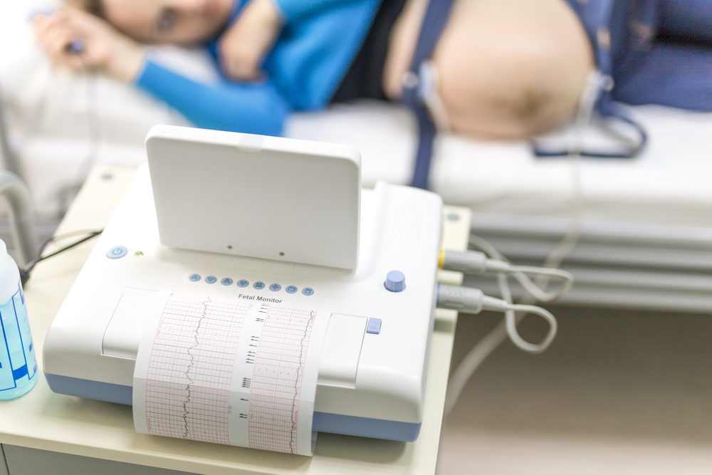 Fetal Heart Rate Decelerations