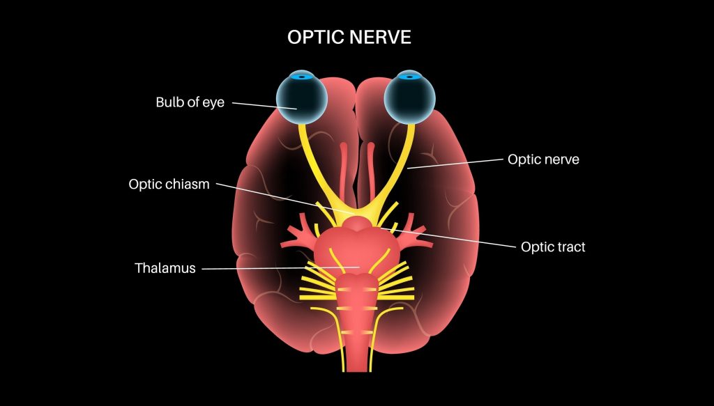 Optic Nerve Medical Malpractice