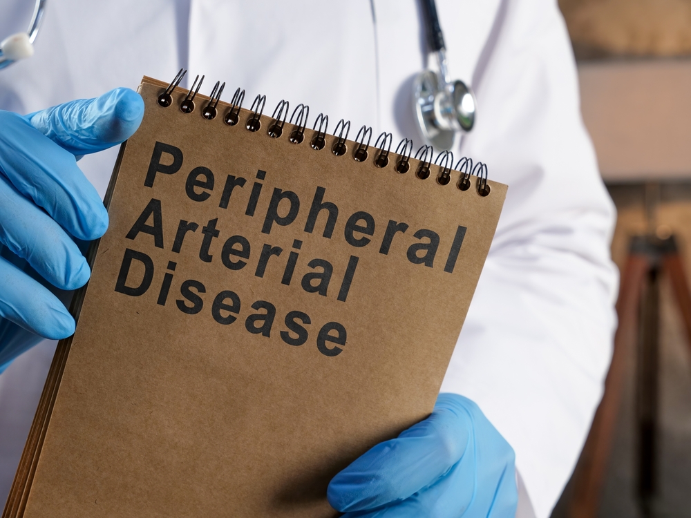 Peripheral Artery Disease Medical Malpractice
