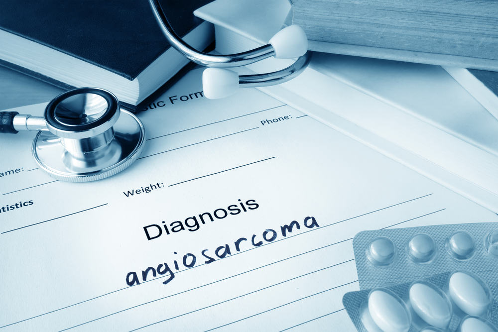Angiosarcoma Medical Malpractice