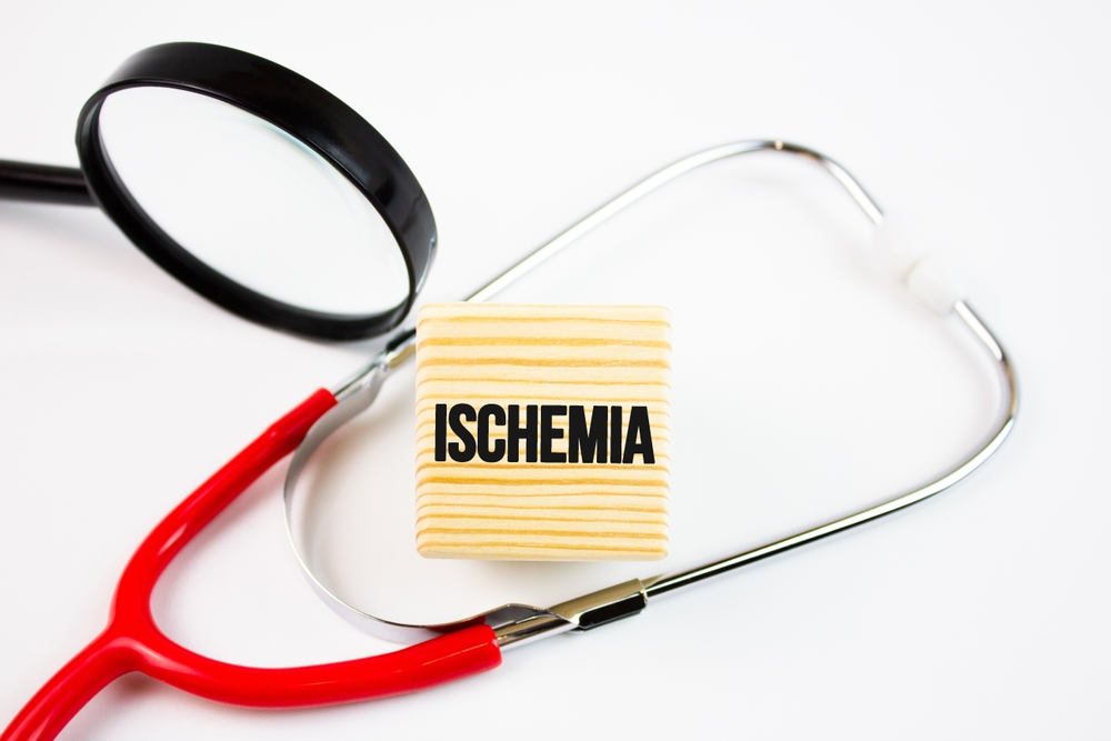 Ischemia Medical Malpractice