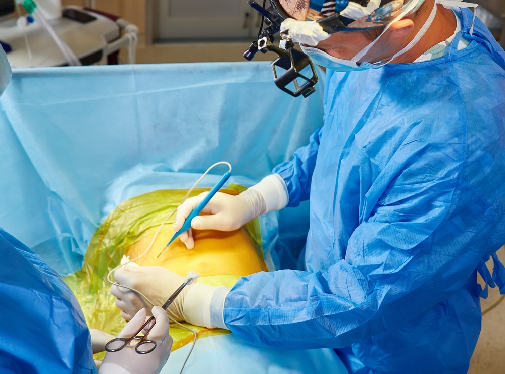Thoracotomy & Medical Malpractice