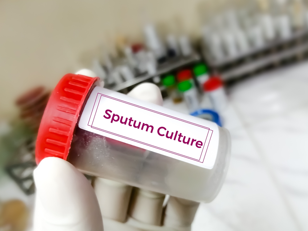 Sputum Test Medical Malpractice