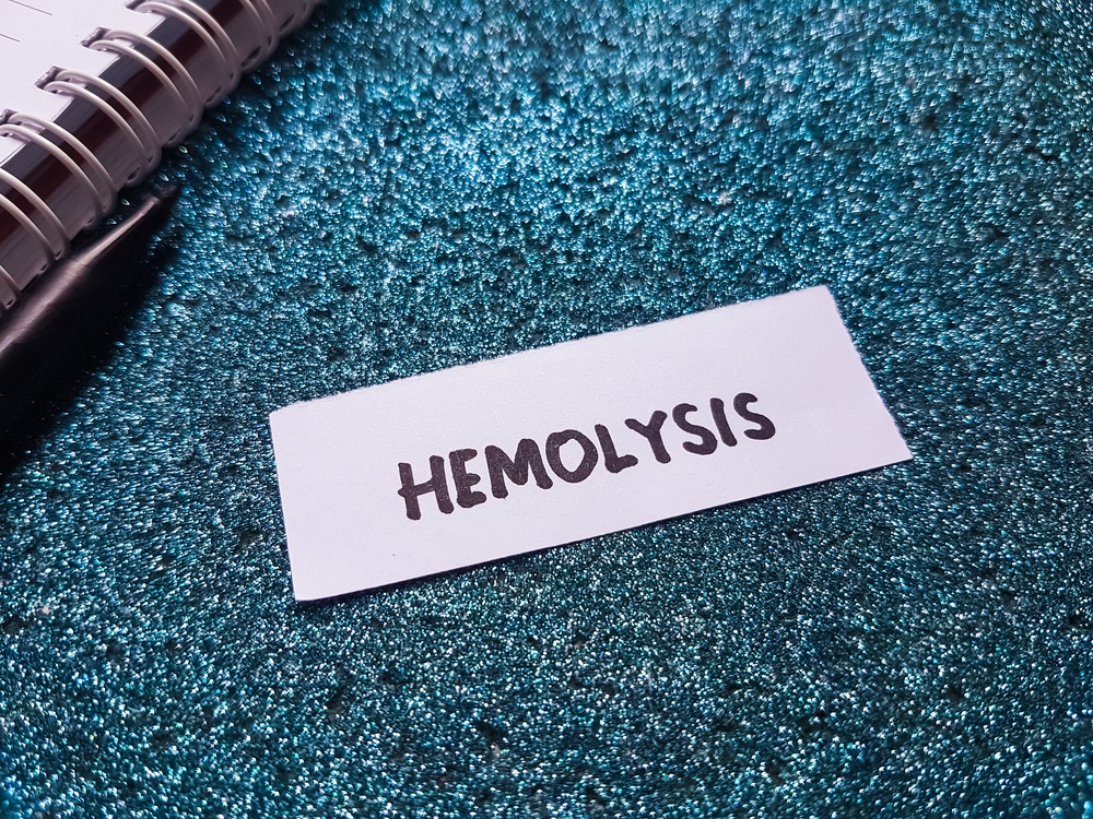 Hemolysis Medical Malpractice