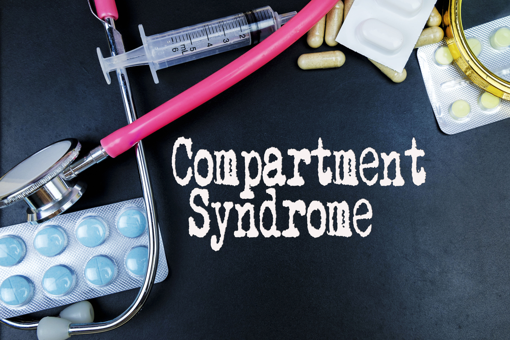 Compartment Syndrome Medical Malpractice