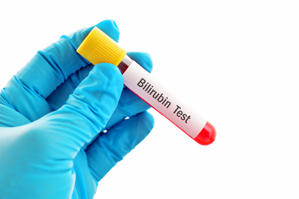 Bilirubin Medical Malpractice
